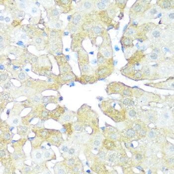 Immunohistochemistry - NAMPT Polyclonal Antibody (144-00256)