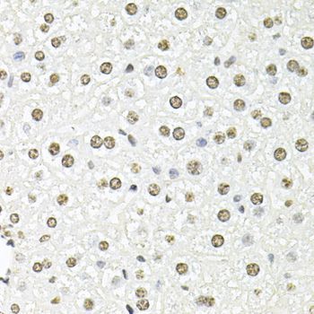 Immunohistochemistry - FBL Polyclonal Antibody (144-60358)
