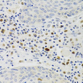 Immunohistochemistry - GEMIN2 Antibody (144-03082)