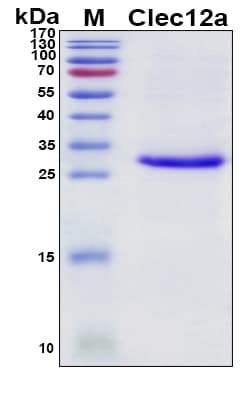 SDS-PAGE Image