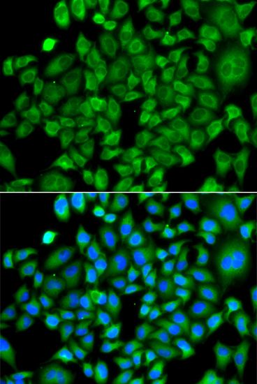Immunofluorescence - NAA50 antibody (144-61406)