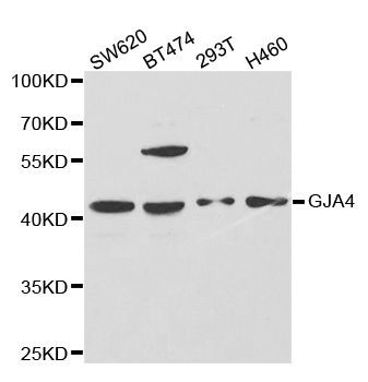 Western blot - GJA4 antibody (144-02529)