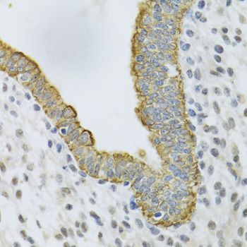 Immunohistochemistry - KRT5 Antibody (144-02662)
