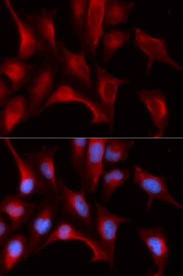 Western blot - PSMB4 Polyclonal Antibody (144-05697)