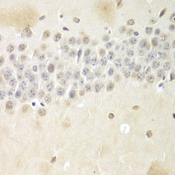 Immunohistochemistry - Nono Antibody (144-05282)