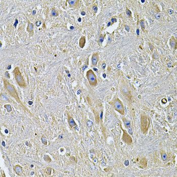 Immunohistochemistry - PLCG1 Antibody (144-07711)