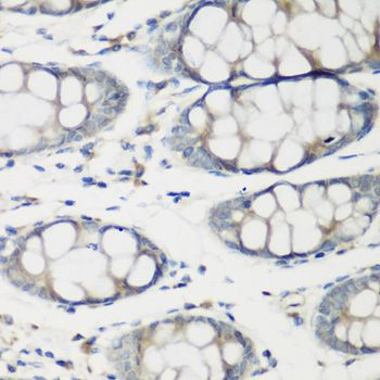Immunohistochemistry - TNNC2 antibody (144-07740)