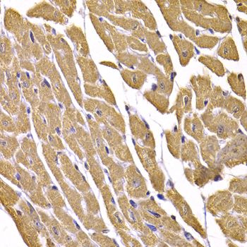 Immunohistochemistry - SLC2A4 antibody (144-07637)