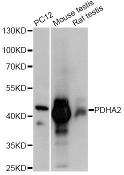 Western blot - PDHA2 Polyclonal Antibody (144-60877)