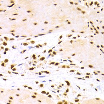 Immunohistochemistry - DDB1 Polyclonal Antibody (144-02896)