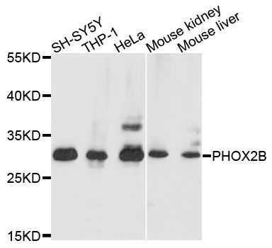 Western blot - PHOX2B antibody (144-09685)