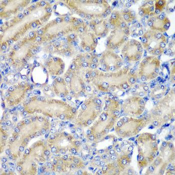 Immunohistochemistry - PDCD6 Polyclonal Antibody (144-06685)