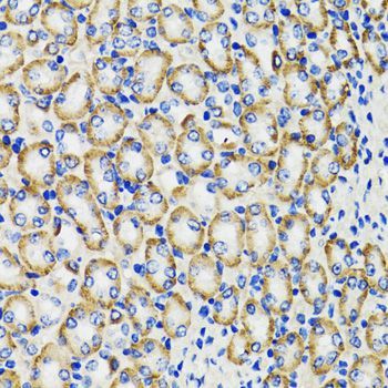 Immunohistochemistry - COMT Polyclonal Antibody (144-06200)