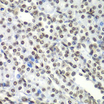 Immunohistochemistry - SF3B2 Polyclonal Antibody (144-05875)