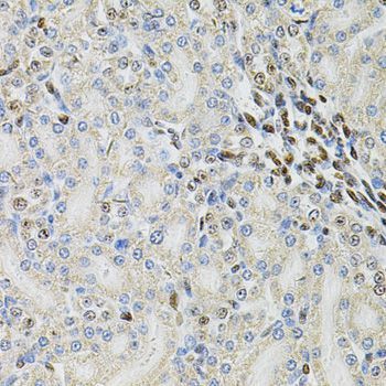 Immunohistochemistry - PSMC3 Antibody (144-01986)
