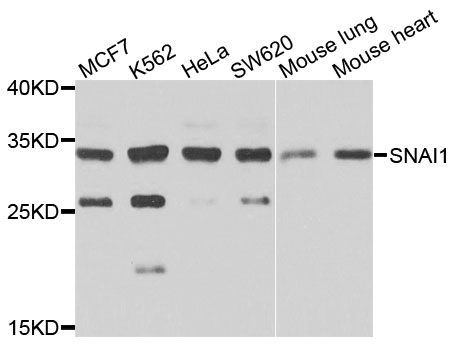 Western blot - SNAI1 antibody (144-05544)