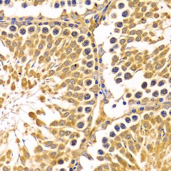 Immunohistochemistry - PIBF1 Antibody (144-03072)