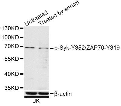 Western blot - Phospho-Syk-Y352/ZAP70-Y319 pAb (144-50501)