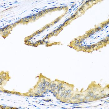 Immunohistochemistry - PENK antibody (144-06302)