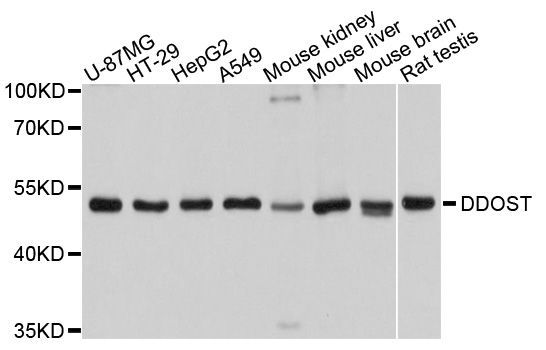 Western blot - DDOST antibody (144-09056)
