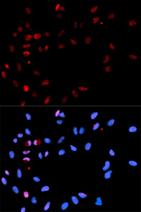 Immunohistochemistry - Phospho-Histone H2AFX-S139 pAb (144-50099)
