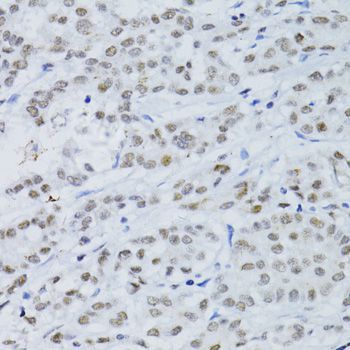 Immunohistochemistry - SNRNP70 antibody (144-06065)