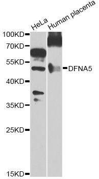 Western blot - DFNA5 Antibody (144-07432)