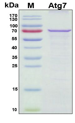 SDS-PAGE