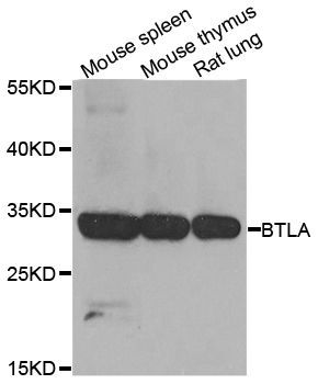 Western blot - BTLA antibody (144-08377)