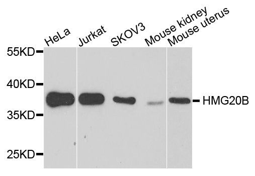 Western blot - HMG20B antibody (144-04408)