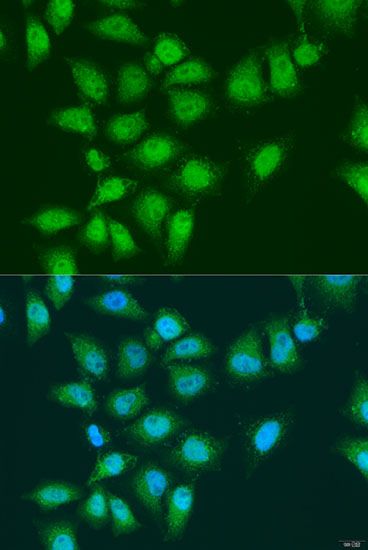 Immunofluorescence - EYA3 Polyclonal Antibody (144-60899)
