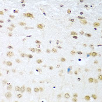 Immunohistochemistry - CCND2 antibody (144-01773)