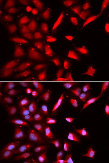 Immunofluorescence - PSMC3 Polyclonal Antibody (144-602925)