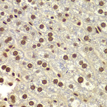Immunohistochemistry - DDX5 antibody (144-60268)