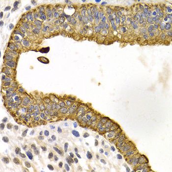Immunohistochemistry - KRT5 Antibody (144-02662)
