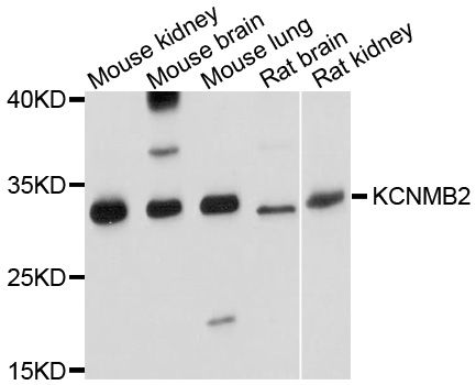 Western blot - KCNMB2 Polyclonal Antibody (144-10277)