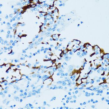 Immunohistochemistry - CTSE antibody (144-02678)