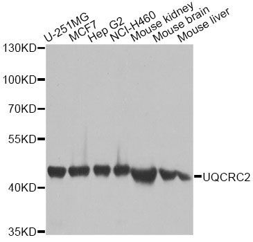 Western blot - UQCRC2 Polyclonal Antibody (144-04181)