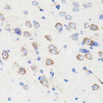 Immunohistochemistry - DLG1 antibody (144-08542)