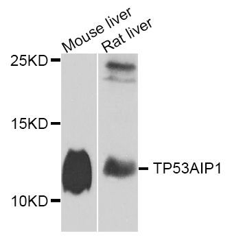 Western blot - TP53AIP1 Polyclonal Antibody (144-07224)
