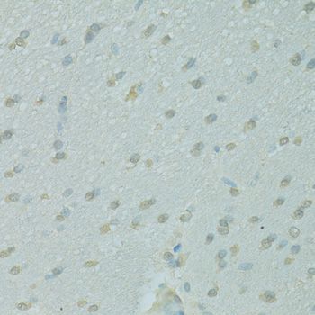 Western blot - [KO Validated] NCOA2 Polyclonal Antibody (144-10280)