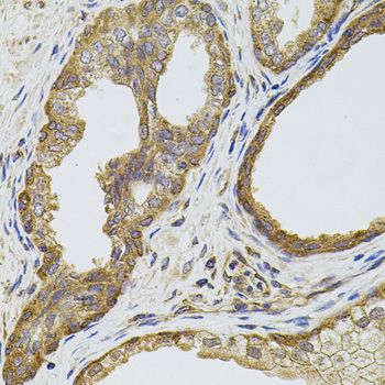 Immunohistochemistry - [KO Validated] EGFR Polyclonal Antibody (144-11351)