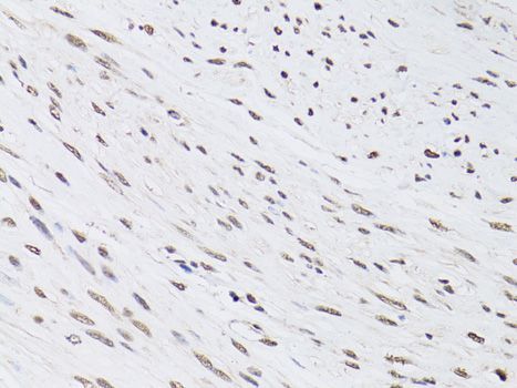 Immunohistochemistry - [KO Validated] PML Polyclonal Antibody (144-01184)