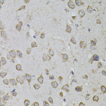 Immunohistochemistry - TRPC3 antibody (144-07742)
