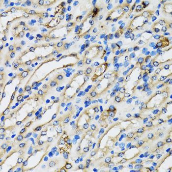 Immunohistochemistry - COPB2 Polyclonal Antibody (144-07036)