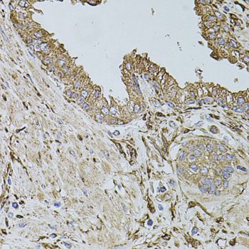 Immunohistochemistry - ALDH1A1 antibody (144-01802)
