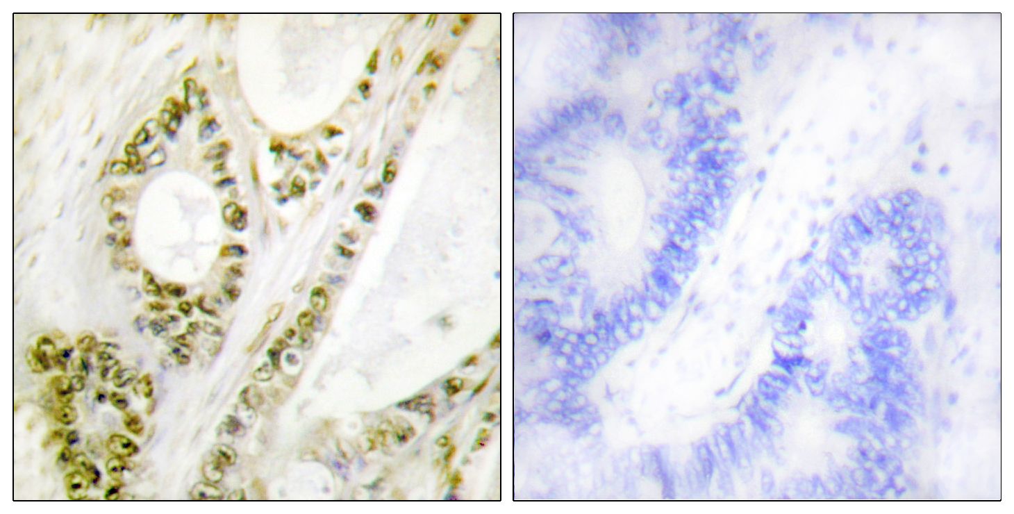 IHC