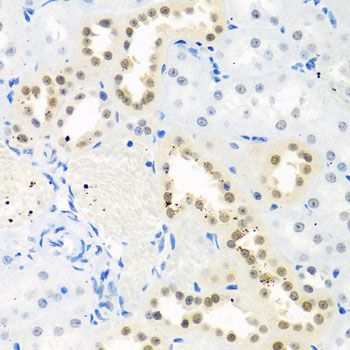 Immunohistochemistry - THOC1 antibody (144-08179)