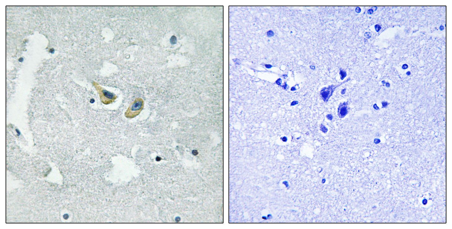 IHC