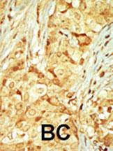 IHC-P
